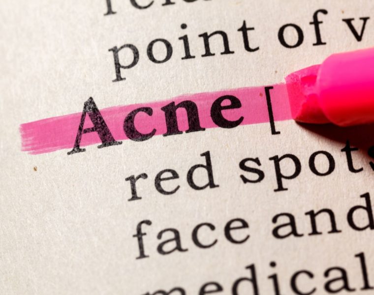 Fungal Acne, Jerawat Yang Disebabkan Oleh Jamur